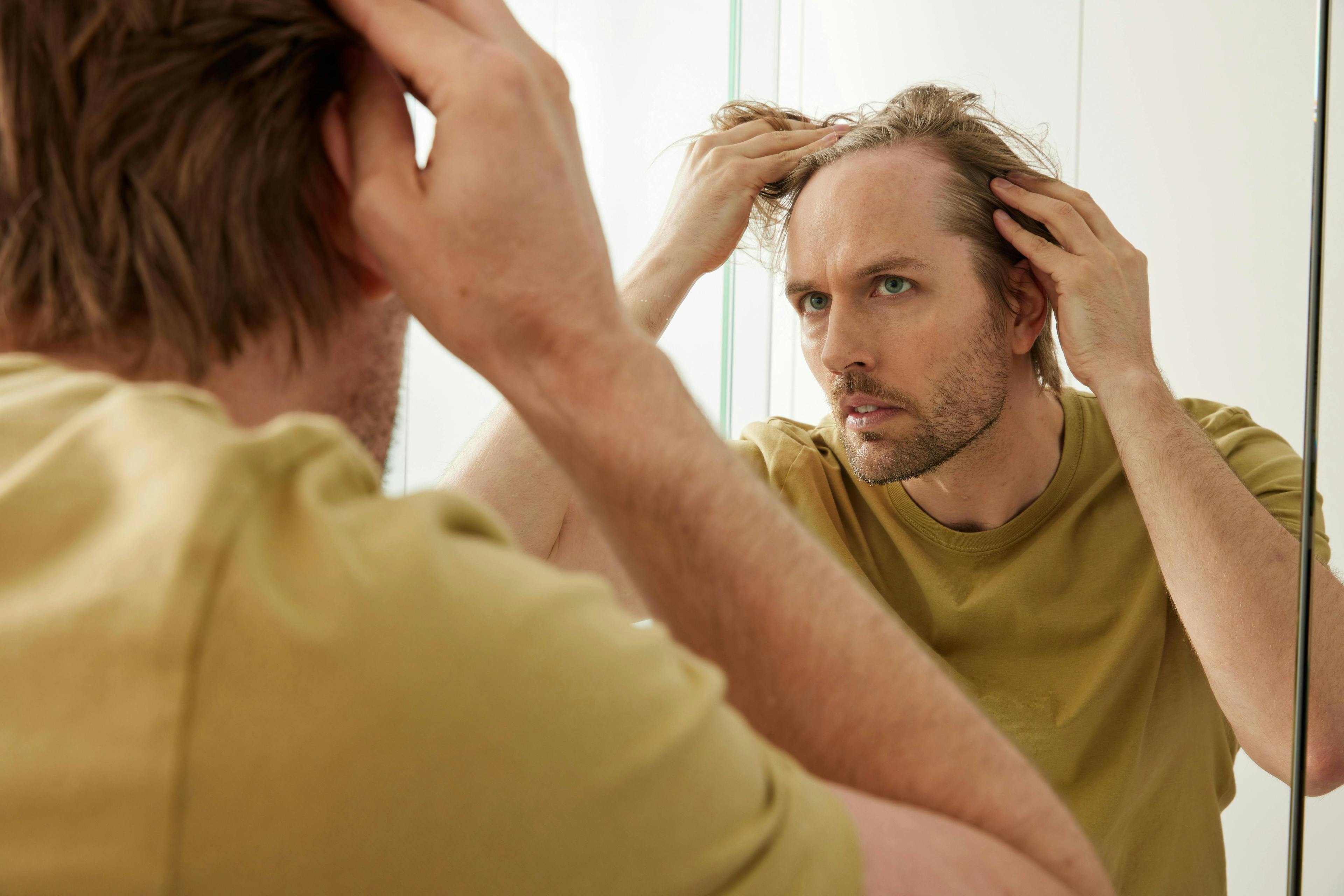 man checking baldness in mirror